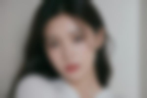 刘海涛医生玻尿酸能让脸部变立体自然