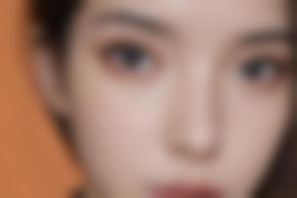 术后能维持多久？