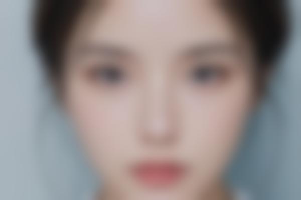 廉惜然轮廓修复三大核心优势