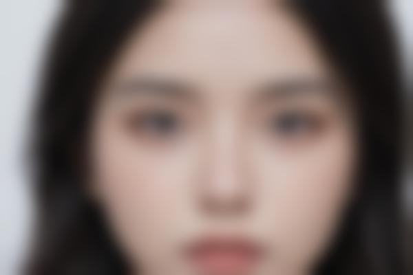 廉惜然轮廓修复价格贵吗？