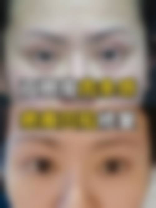 北京米兰柏羽丽都医疗美容医院面部抗衰套餐医生推荐