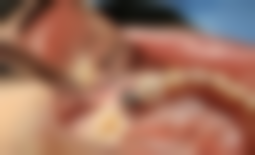 安徽渡江口腔医院合肥门诊部怎么预约？