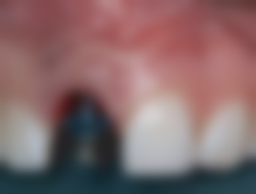 伍正辉预约方式