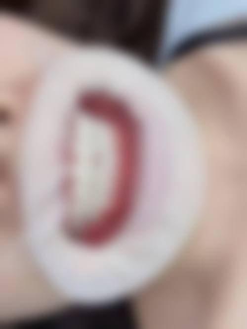 重庆韩佳牙博士口腔医院实例参考