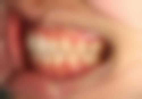 滨州医学校附属烟台口腔医院口腔正畸科价格表（仅供参考）