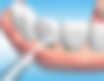 固安维斯口腔实例参考