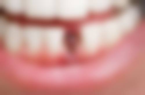 西宁洁雅口腔门诊实例参考