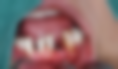 广东广州暨南雅皓口腔门诊部怎么预约？