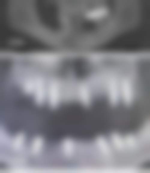 深圳康进口腔诊所核心项目