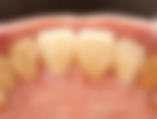 广州贝颐美诊所价格表（仅供参考）