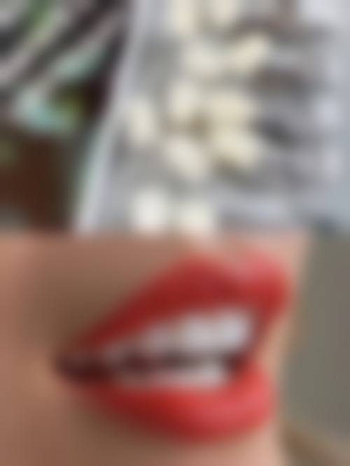 镇江维尔建口腔(宝华店)价格表(仅供参考)