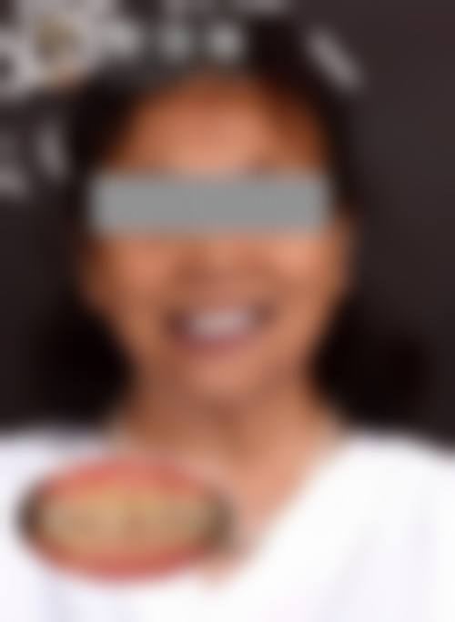 禹城木华口腔诊所实例参考