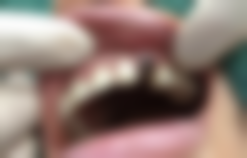 江西萍乡辉亮口腔核心项目