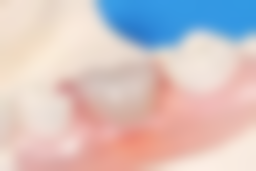 温海燕预约方式