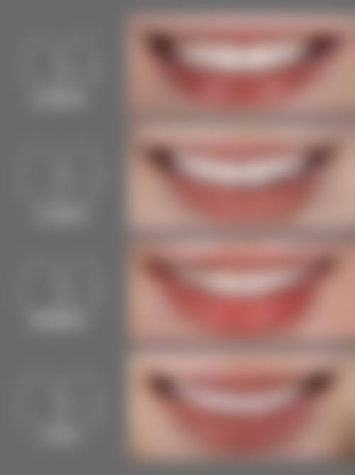 温海燕擅长项目列表