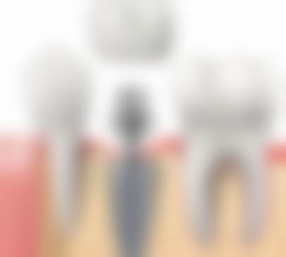 岳阳铭远口腔核心项目