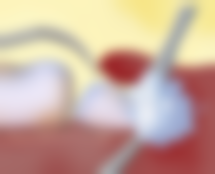 叶齿维乐口腔门诊部价格表（仅供参考）