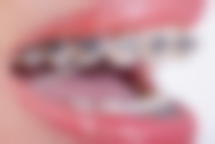 重庆八益牙科价格表（仅供参考）