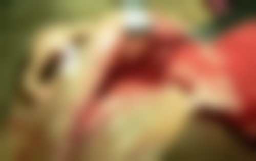 上蔡小苹果口腔(鹏宇店)实例参考