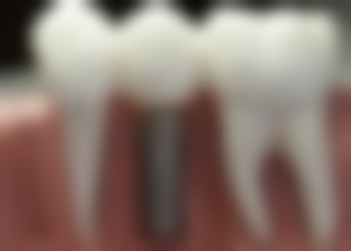 嘉兴雅美口腔门诊部价格表(仅供参考)