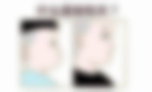 侯成群擅长项目列表