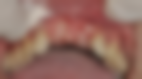 山东潍坊高新久誉口腔核心项目