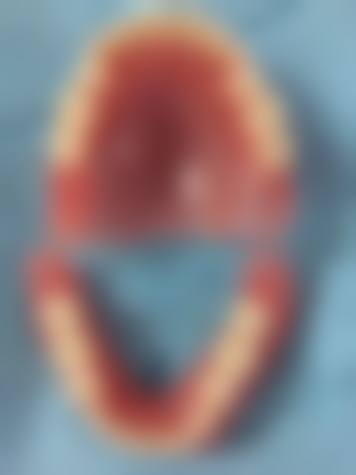 杨高强擅长项目列表