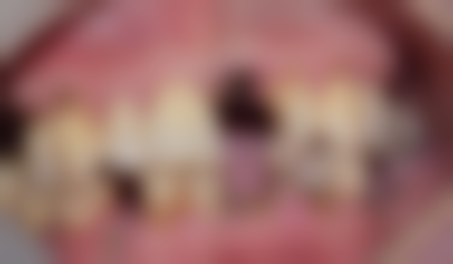 成都爱贝尔口腔（北湖国内外城店）实例参考