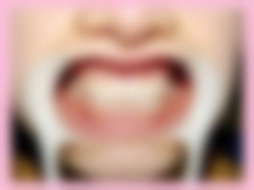 侯成群预约方式