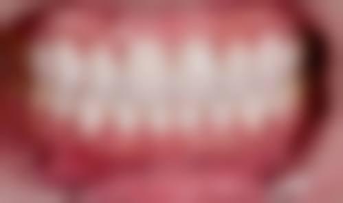 梅红娟预约方式