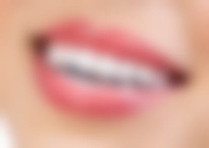 西安文信口腔诊所怎么预约？