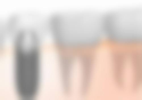 昆山大德口腔核心项目