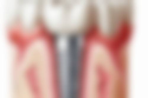 襄阳谷城牙管家口腔门诊部实例参考