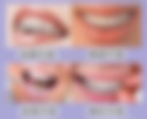 昆山大德口腔怎么预约？