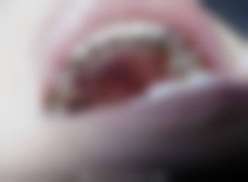 尤旦口腔医院价格表(仅供参考)