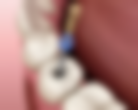 广东广州李育成牙科怎么预约？