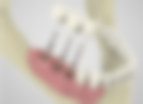 山东烟台天使口腔怎么预约?