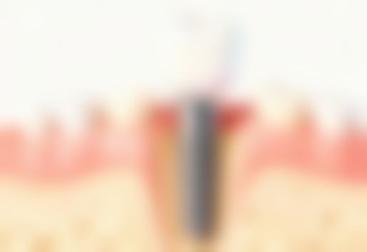 西宁市贝佳口腔门诊部价格表（仅供参考）