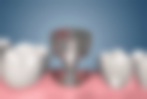 杭州瑞创口腔(萧山旗舰总院)价格表（仅供参考）