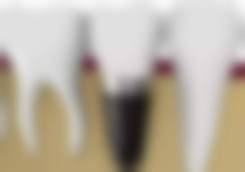 绵阳海豚口腔诊所价格表(仅供参考)