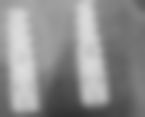 长春百易口腔(力旺康城店)实例参考