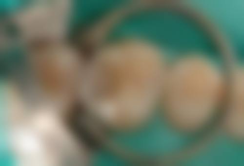 健美口腔(易俗河店)实例参考