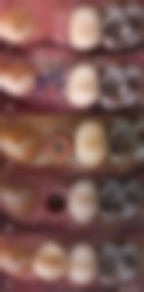 健美口腔(易俗河店)价格表(仅供参考)