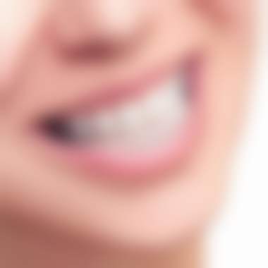 深圳华侨医院口腔科价格表(仅供参考)