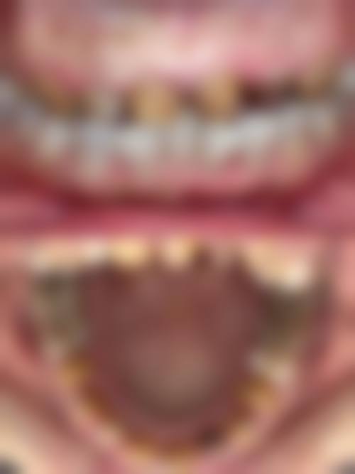 邹玉昆预约方式