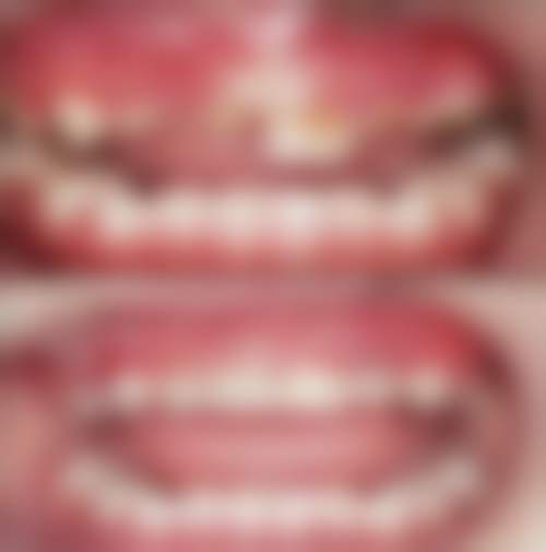 深圳华侨医院口腔科