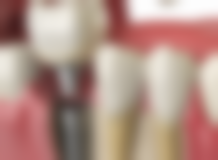 绵阳海豚口腔诊所怎么预约?