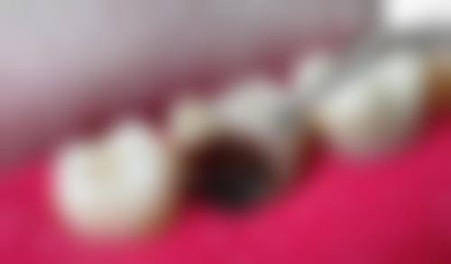 王冰蓉患者评价