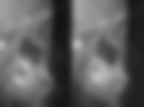 韩国4ever整容外科医院实例参考