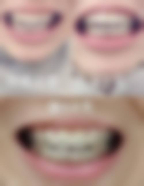 泰安杰瑞口腔核心项目